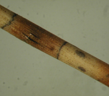 Detail acervuli na jehlici borovice, laboratoř ÚOLM LDF Brno 2010.